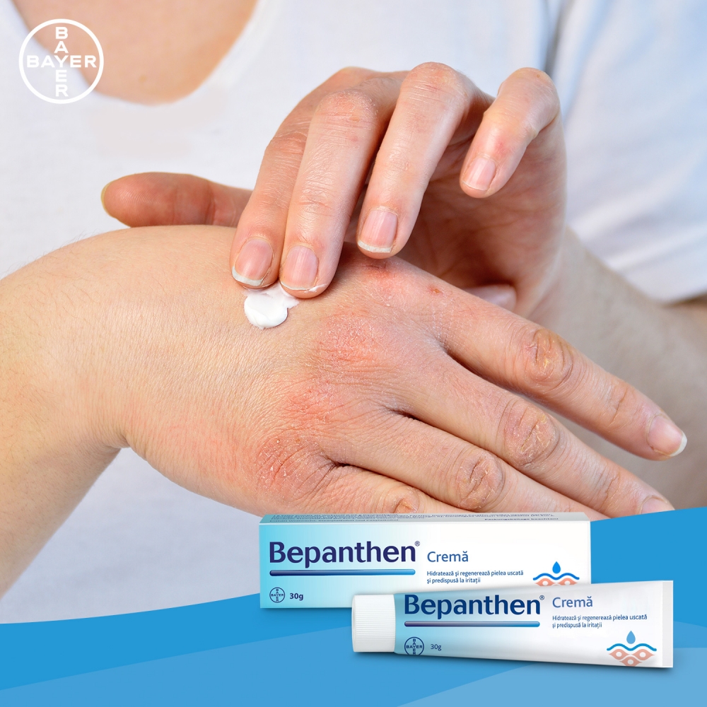 Bepanthen Crema 30g - Hidratare și Regenerare - imagine 4
